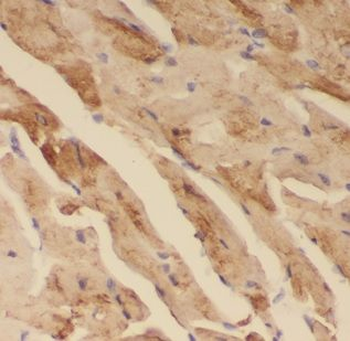 NDUFS5 Antibody