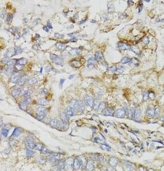 NDUFS7 Antibody