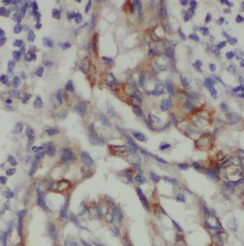 NDUFV1 Antibody