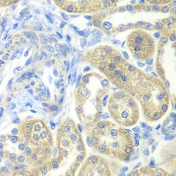 NDUFV2 Antibody