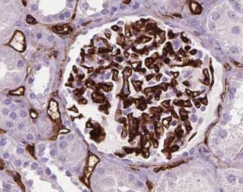NECTIN2 Antibody