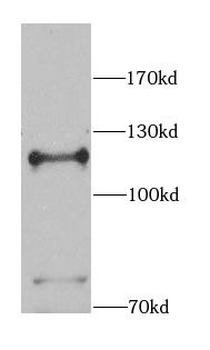 NEDD4 Rabbit Polyclonal Antibody
