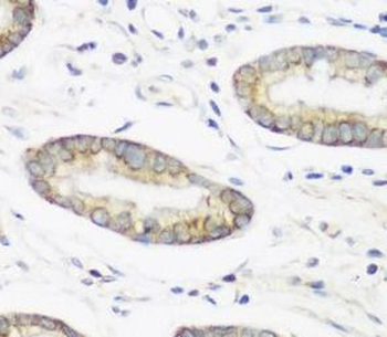 NEDD4 Rabbit Polyclonal Antibody