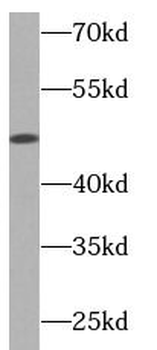 NEIL1 Antibody