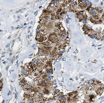 NSMF Antibody