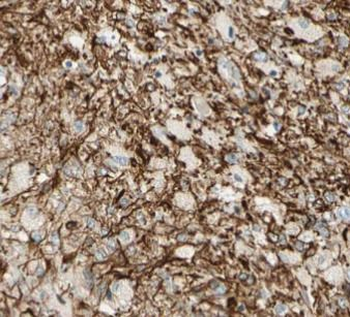 NES Antibody