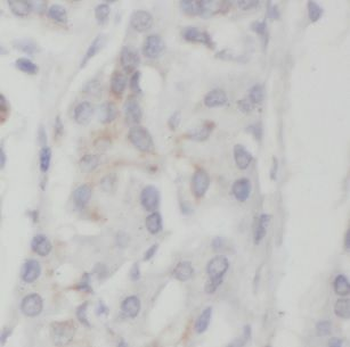 NEUROD1 Antibody