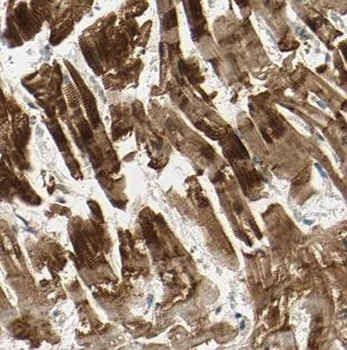 NAV1 Antibody
