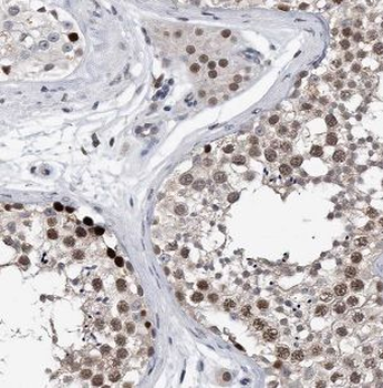 NFATC2 Antibody