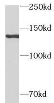 NFATC3 Antibody