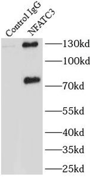 NFATC3 Antibody