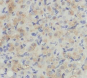 NFATC3 Antibody