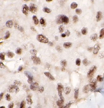 NFE2L1 Antibody