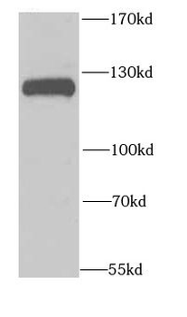 NFKB1 Rabbit Polyclonal Antibody
