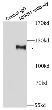 NFKB1 Antibody