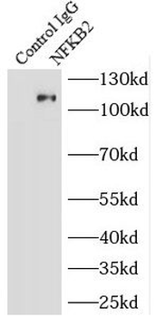 NFKB2 Antibody