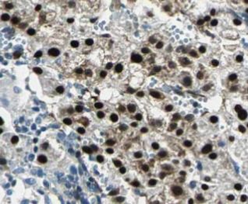 NFKB2 Antibody