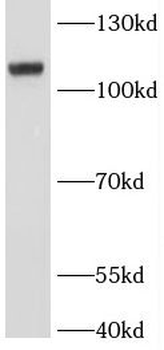 NFKB2 Rabbit Polyclonal Antibody