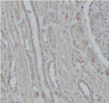 NFKB2 Rabbit Polyclonal Antibody
