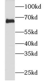 NEFL Mouse Monoclonal Antibody