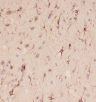 NEFL Mouse Monoclonal Antibody