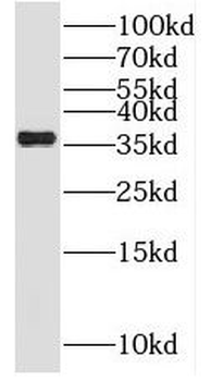 NGDN Antibody