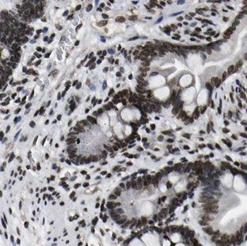 TMEM8B Rabbit Polyclonal Antibody