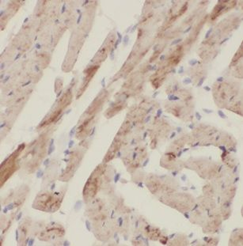 NHLRC1 Antibody