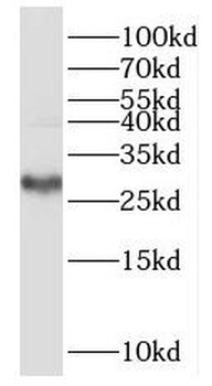 PSME3IP1 Rabbit Polyclonal Antibody