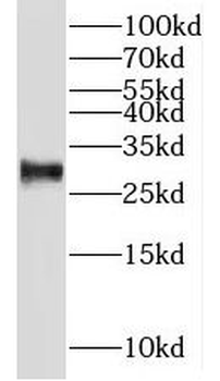 NIPSNAP3B Antibody