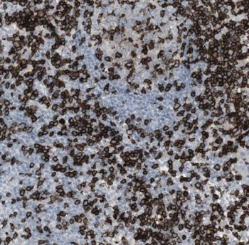 NIPSNAP3B Antibody