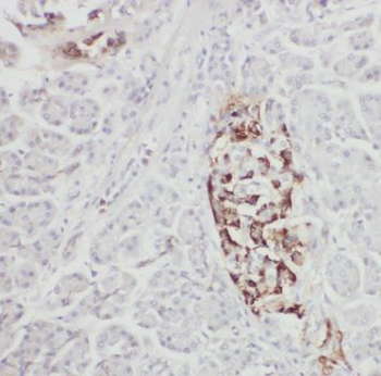 NIT1 Antibody