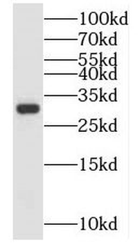 NIT2 Antibody