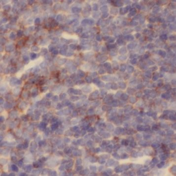 NKTR Antibody