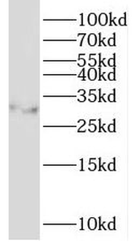 NKX2-2 Antibody