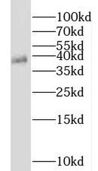 NKX3 2 Rabbit Polyclonal Antibody