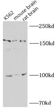 NLRP1 Antibody