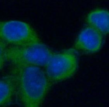 GRIN2A Antibody