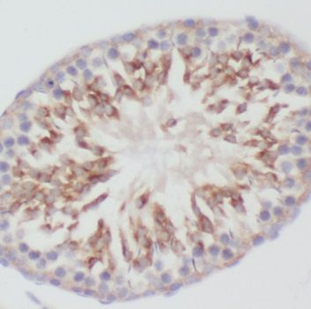 NME5 Antibody