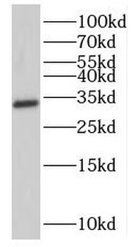 NMRAL1 Antibody