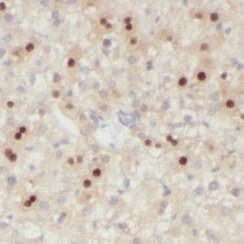 NMRAL1 Antibody