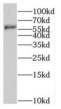 NMT1 Antibody