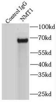 NMT1 Antibody