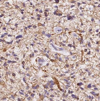NMT1 Antibody