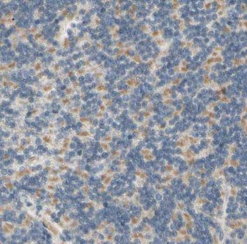 NMU Rabbit Polyclonal Antibody