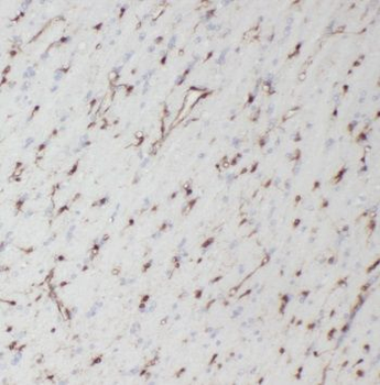 NMUR1 Antibody