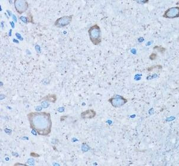 NNMT Antibody