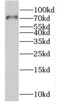 RIOX1 Antibody