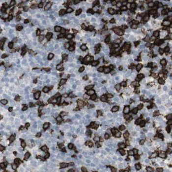 NOB1 Antibody