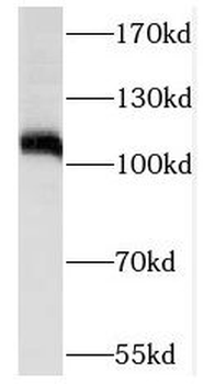 NOP2 Antibody